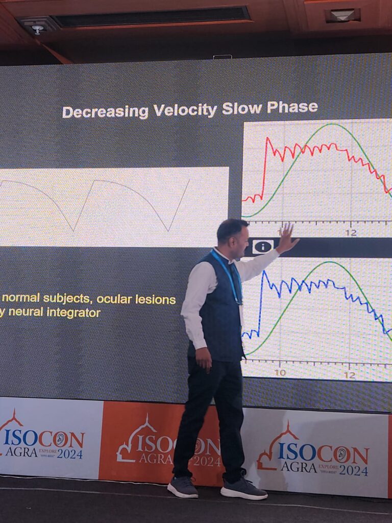 VNG Testing: Comprehensive Vestibular Assessment for Complex Dizziness