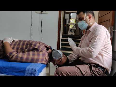 posterior canal bppv