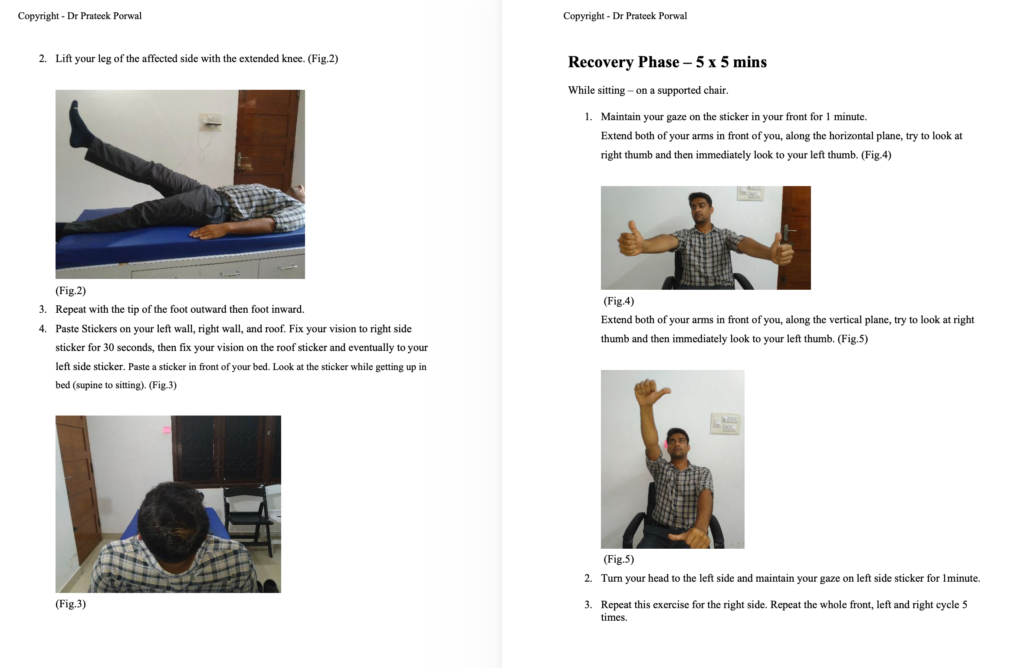 Vestibular Rehabilitation After Neuritis