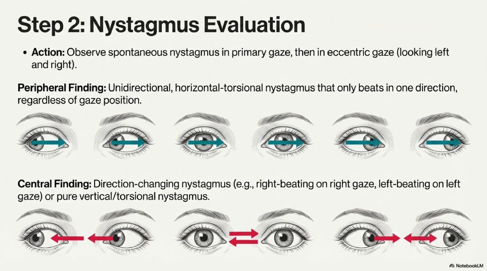 Educational diagram on nystagmus assessment within the HINTS exam — direction of fast phase, gaze-evoked changes, and clinical interpretation