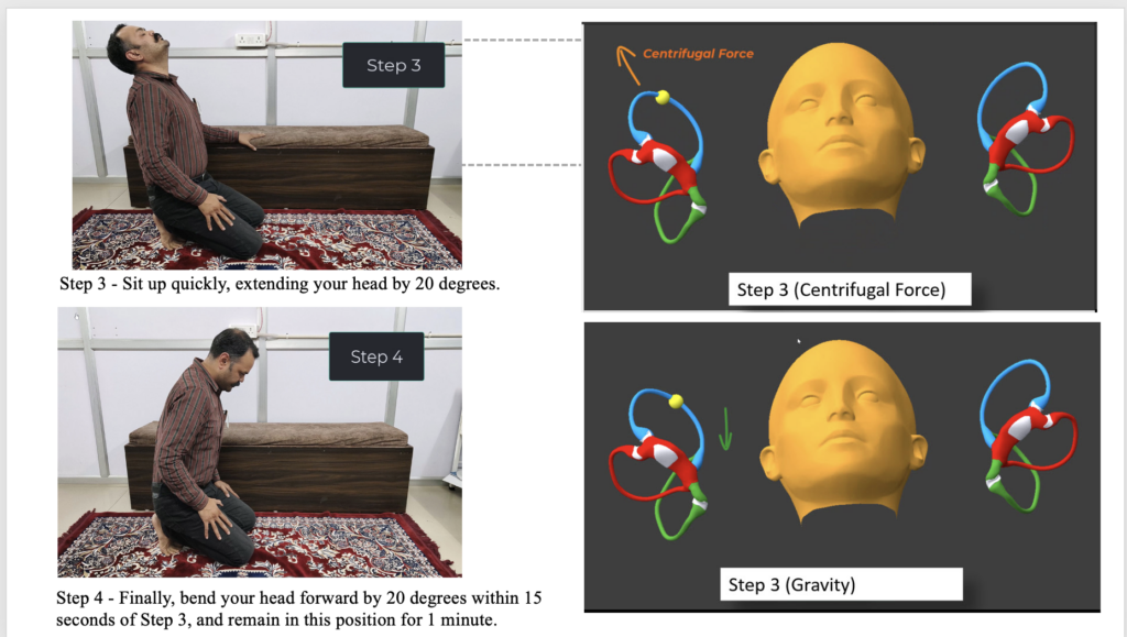 Bangalore Maneuver Step 3 and 4