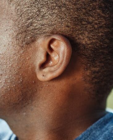 Close-up of a person's external ear and side of head — acoustic neuroma symptoms | Dr. Prateek Porwal, ENT