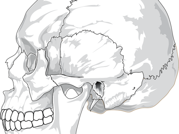 Lateral view illustration of a human skull, highlighting ear structures — चक्कर येणे आणि वर्टिगो | Dr. Prateek Porwal, ENT