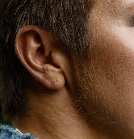 Close-up of a human ear and side of head — vestibular neuritis | Dr. Prateek Porwal, ENT